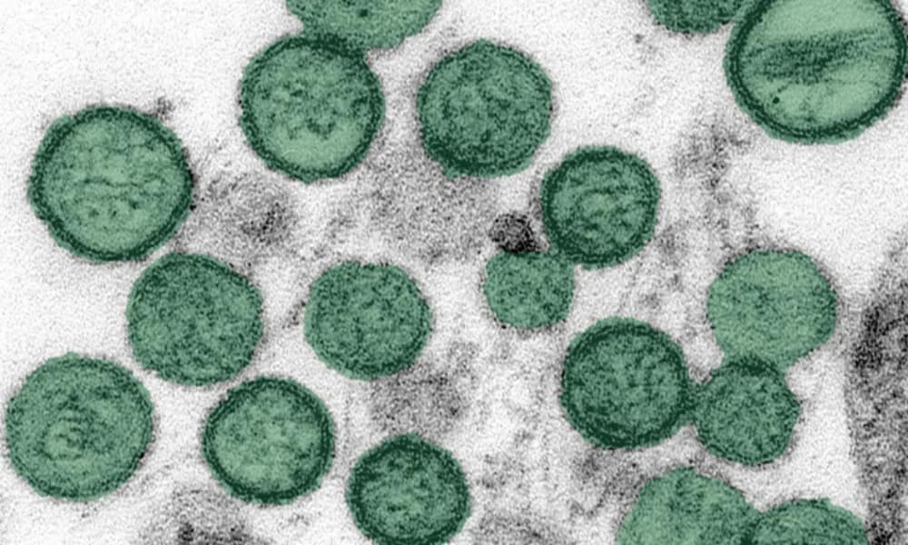 Hantavirus : Israël et la France touchés par le virus venu du navire maudit